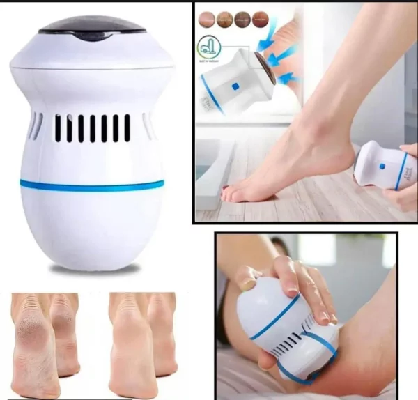 Rechargeable Foot Grinder & Callus Remover